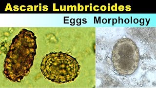 Ascaris lumbricoides eggs Morphology [upl. by Cyrillus]