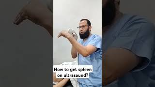 Ultrasound of spleen [upl. by Eikcuhc]