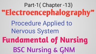 EEGProcedure Applied To The Nervous System [upl. by Iene979]