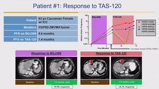 2018 Cholangiocarcinoma Foundation Annual Conference 11  Day 2  FGFR Inhibition [upl. by Noitsuj]