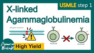 X linked agammaglobulinemia  Agammaglobulinemia  XLA USMLE step 1 [upl. by Otit]