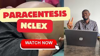 PARACENTESIS  All you need to know  NCLEX Review [upl. by Irolam124]