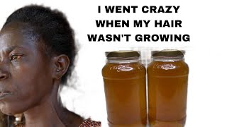 NO JOKE THIS HAIR GROWTH RECIPE GREW MY HAIR 10x FASTER THIS WILL SAVE LIVES [upl. by Ricardama]