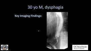 Imaging of esophagus [upl. by Amolap]