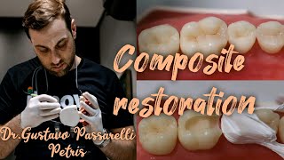 Composite restoration Composite modeling of tooth anatomy Dr Gustavo Passarelli Petris [upl. by Ixela234]