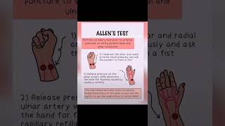 ALLENS TEST [upl. by Olvan]