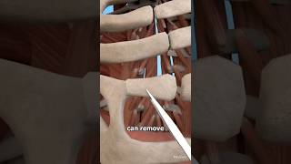 Rebuilding A Jaw With Rib Bone😴😮 3danimation humanbodyshorts [upl. by Sida]