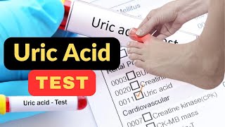 Uric acid test  Uric acid test kasy krty hai  What is Uric acid test  uricacid [upl. by Hiasi]