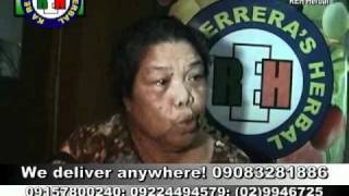 Kings Herbal Testimonial  Breast Cancer Remedios Quino [upl. by Venola859]