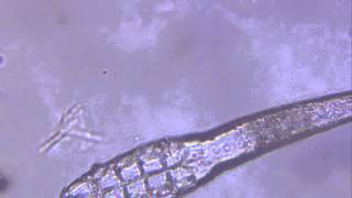 Demodex canis [upl. by Camila]