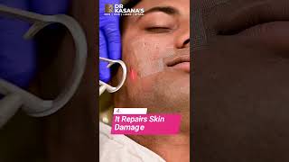 Get Flawless Skin with Fractional CO2 Laser Treatment  DrLalit Kasanas [upl. by Nyluqcaj170]