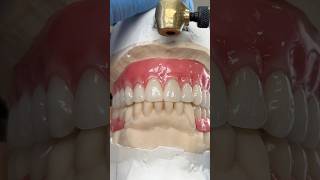 Denture and Metal Partial TryIn ​⁠EnvisiontecMain envisiontec lsk121shorts dentist teeth [upl. by Esyla]