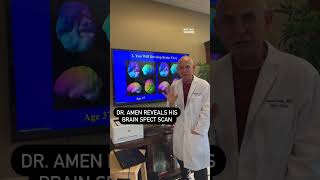 Dr Daniel Amen Reveals His Brain Scan [upl. by Boony]