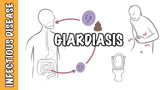 Giardiasis  Giardia Lamblia Giardia intestinalis Giardia duodenalis infection [upl. by Cony]