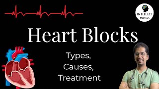 Heart Blocks Types Causes ECG findings Treatment [upl. by Akirahc]