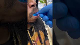 Custom Moissanite or lab diamond grillz in NYC [upl. by Amil476]