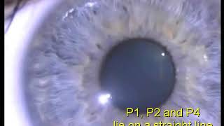 Purkinje images in normal eye [upl. by Dennis]