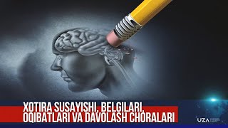 Xotira susayishi belgilari oqibatlari va davolash choralari [upl. by Floyd]