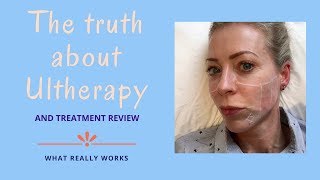 The truth about Ultherapy  Alice HartDavis [upl. by Coster]