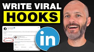 How to Write LinkedIn Opening Hooks And Go Viral [upl. by Aisetra854]