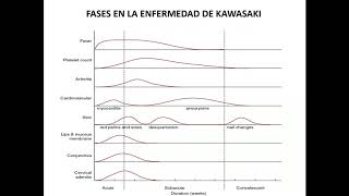 Enfermedad de Kawasaki  Dr Enrique Faugier Fuentes [upl. by Ole265]