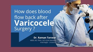 How does blood flow after Varicocele Surgery Surgery ke baad testis se khoon wapas kaise jata hai [upl. by Nichani403]