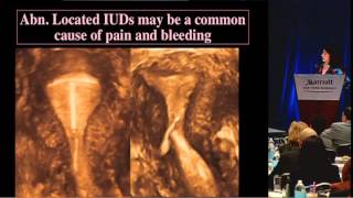 Ultrasound First and Imaging of the Pelvis  Beryl Benacerraf MD [upl. by Gideon909]