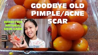 KAMATIS TOMATO EPEKTIBONG PANTAGGAL NG PEKAS AT OLD ACNE SCARS SA MUKHAkamatisantiblemishes [upl. by Irbua]