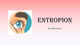 Entropion causes complications treatment and management [upl. by Gies]