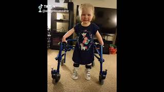 Arthrogryposis Diagnosis and Treatment  Patient Testimonial Ana [upl. by Nithsa]