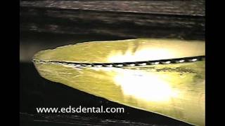 Cutting action of a endodontic file vs reamer [upl. by Halvaard513]