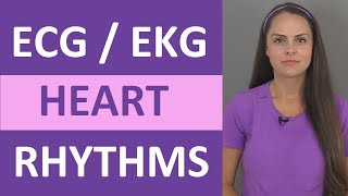 EKG Rhythms  ECG Heart Rhythms Explained  Comprehensive NCLEX Review [upl. by Rezeile939]