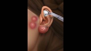 Asmr ear cleaning [upl. by Yecam]