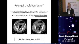 Traiter par voie basse une fistule des anastomoses colorectales et colaanales Dr chafai [upl. by Ruzich590]