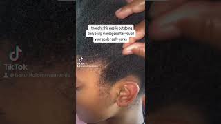 5 Hair Growth Oil SALE blackfriday hairgrowthoil hairloss shorts [upl. by Adalia]