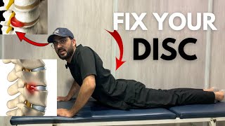 Herniated amp bulge disc excercises amp StretchesFix your Disc [upl. by Lexine]