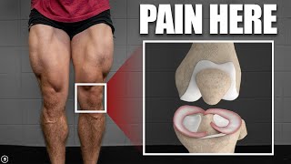 Meniscus Tear Rehab amp Exercises Stretching  Strength  Plyometrics [upl. by Apfel]