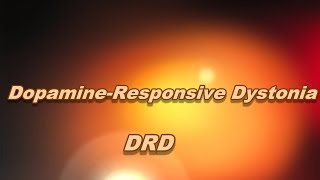 Dopamineresponsive dystonia [upl. by Kubetz]