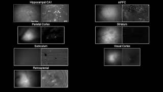 Example Miniscope recordings from different brain regions [upl. by Aniri]