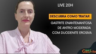 Descubra como tratar gastrite enantemantosa de antro moderada com duodenite erosiva [upl. by Reiser847]