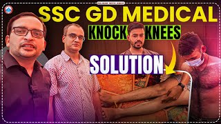 SSC GD Medical 2024 Knock Knees Solution Rojgar With Ankit rojgarwithankit rwa [upl. by Qiratla]