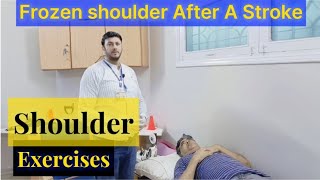 Frozen Shoulder After A Stroke [upl. by Mirisola229]