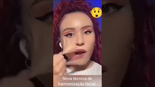 Nova técnica de harmonização facial [upl. by Aicirtak]