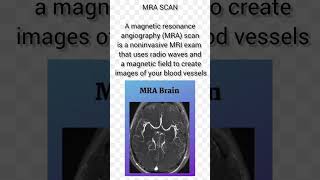 Scanbscnursing hospital scan diagnosis xraysscience laser ctscan mri petscanviralshorts [upl. by Wilbur]