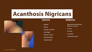 Acanthosis Nigricans  What is Acanthosis Nigricans amp What are its CAUSES [upl. by Steddman]