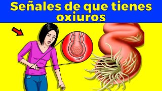 Señales de alarma de que tienes oxiuros parásitos intestinales [upl. by Salsbury915]