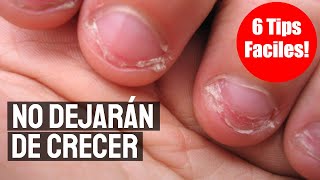 Como Hacer Que Las Uñas Crezcan En 2 Dias ☂ Tratamiento Para Crecer Las Uñas [upl. by Aisyle]