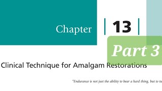 Clinical Technique for Amalgam Restorations part 3 Class 2 Amalgam Restorations Matrix and Wedges [upl. by Hobart231]