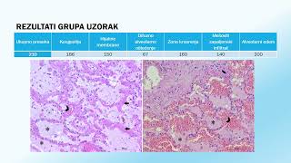 Doktorat  Jelena Kuzmanović  Uloga interleukina 6 8 i 18 u patogenezi akutnog respiratornog [upl. by Sundberg]