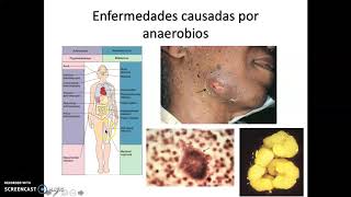 Bacilos Gram positivos y anaerobios [upl. by Egan]